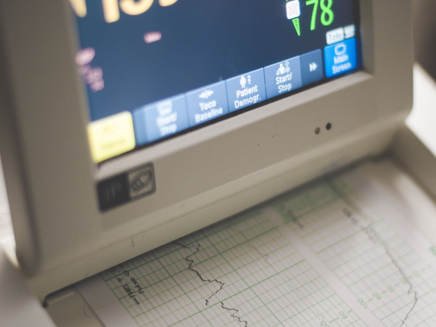 retrieval quality beats model choice article